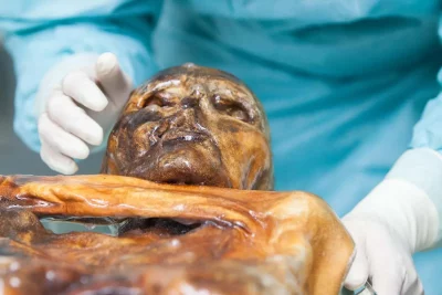 Restos de Ötzi o Homem do Gelo são examinados em laboratório. (Foto: newscientist.com)