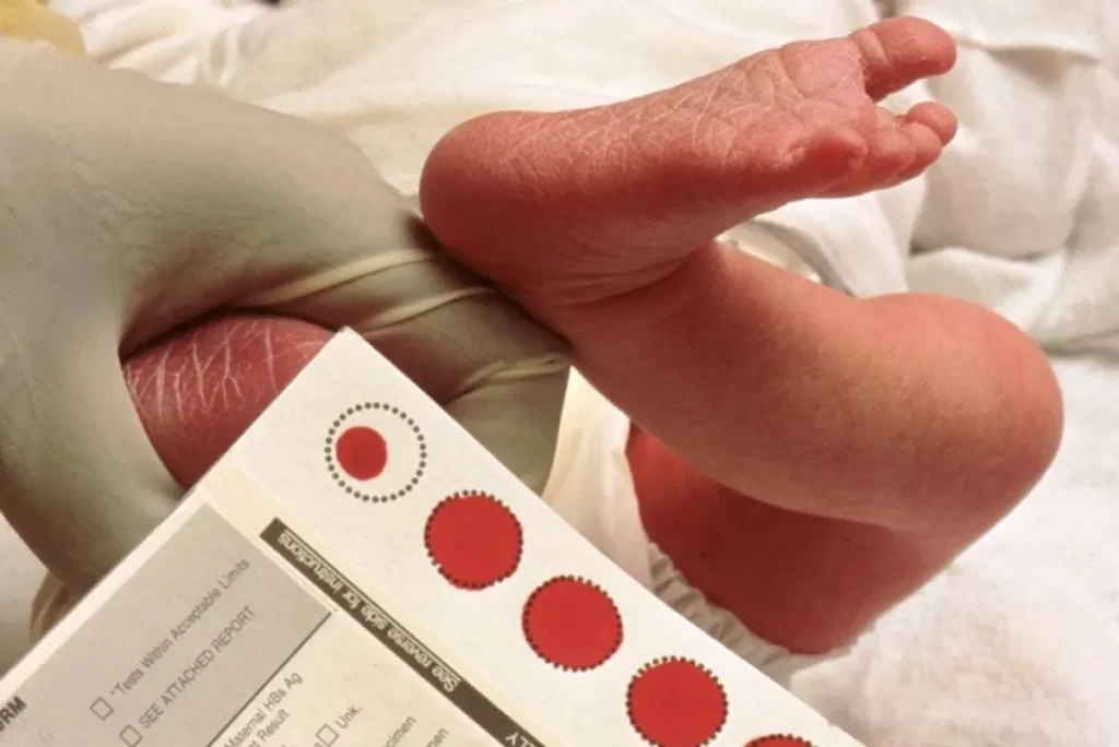 Bebê recebe teste do pezinho com material médico ao lado. (Foto: metropoles.com)