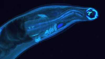 Imagem de um verme parasita, possivelmente um lombriga, em destaque sobre fundo escuro. (Foto: phys.org)