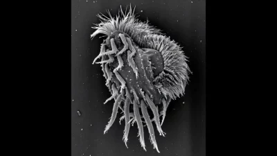 Microscópico organismo transformado em "supergiant" cannibalístico, segundo imagem de microscopia eletrônica. (Foto: phys.org