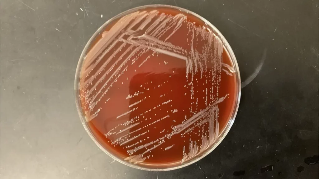 Cultura de micro-organismos em placa de Petri, mostrando desenvolvimento bacteriano. (Foto: phys.org)
