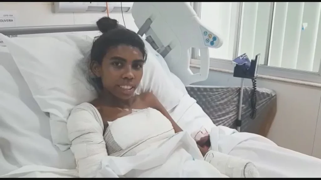 Mulher ferida em acidente é vista em leito hospitalar com bandagens no braço e no corpo. (Foto: g1.globo.com)